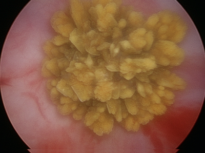 犬の膀胱鏡で見た膀胱結石