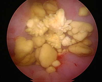 犬での膀胱内の結石