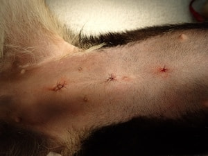 腹腔鏡下避妊手術後の傷口